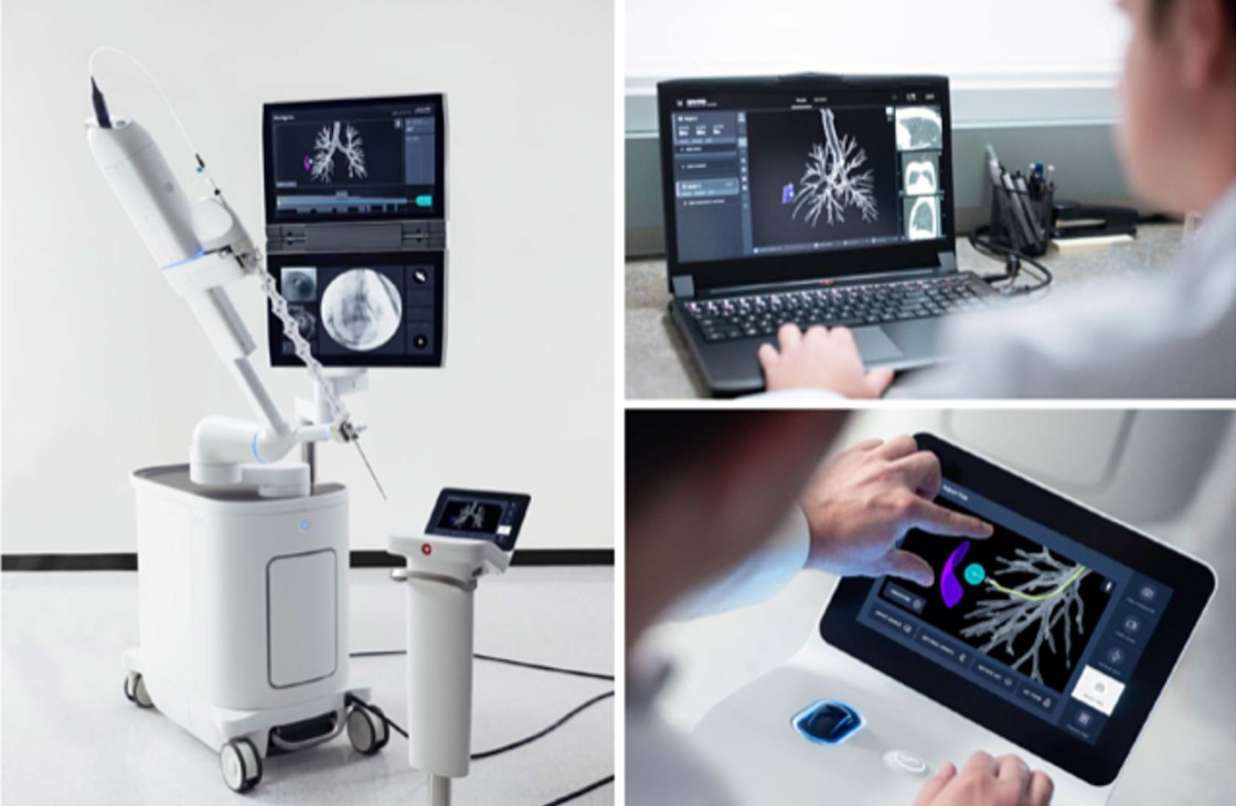 minimally invasive ION robotic-assisted bronchoscopy