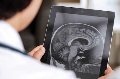 How Telemedicine is Changing Stroke Treatment  